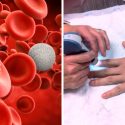 Crean dispositivo para detectar las caídas de glóbulos blancos desde casa