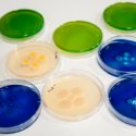 Hallan una clase de proteínas eficaces contra superbacterias resistentes a medicamentos