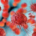 Descubren por qué algunos cánceres se 'resisten' a la inmunoterapia