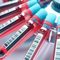 Descubren un test de sangre que detecta hasta siete tipos de cáncer