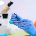 Científicos mexicanos desarrollan protocolo de biopsia cerebral