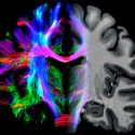 Estudio revela que el consumo de hongos alucinógenos aumenta las conexiones cerebrales