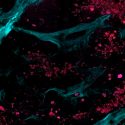 Nuevo método de imagen no invasivo detecta el cáncer a nivel molecular