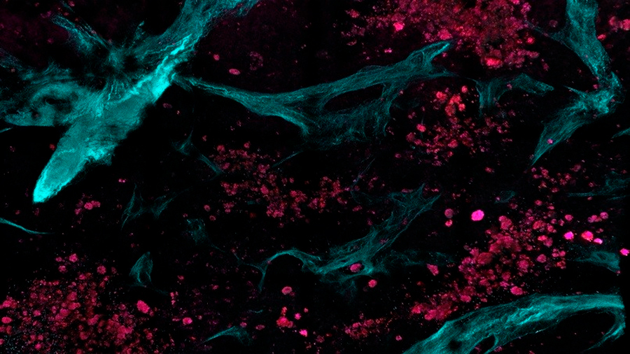 Nuevo método de imagen no invasivo detecta el cáncer a nivel molecular
