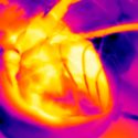 Un biomarcador predice con antelación el riesgo cardiovascular en personas sin síntomas