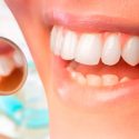China: científicos aseguran haber creado gel que repara el esmalte perdido en los dientes