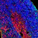 Descifran las bases moleculares de la predisposición a la leucemia