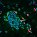 Células cancerosas se tornan caníbales para sobrevivir a quimioterapia