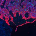 Descubren la hoja de ruta del crecimiento del cáncer