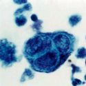 Nueva vacuna contra el herpes genital fue probada exitosamente en ratones y cobayas