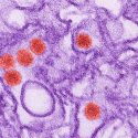 Virus del Zika también afecta y se replica en el cerebro adulto