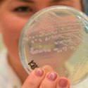 Hallan y logran observar bacterias que se deshacen de su pared celular para evadir a los antibióticos