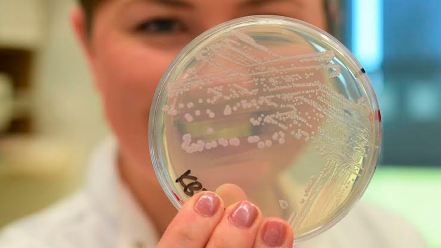 Hallan y logran observar bacterias que se deshacen de su pared celular para evadir a los antibióticos