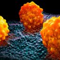 Descubren cómo se alimenta el cáncer de páncreas agresivo