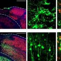 Logran con terapia génica regenerar neuronas pérdidas en accidentes cerebro vasculares