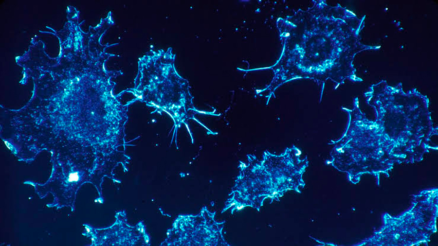 Nueva inmunoterapia trabaja detectando células cancerosas ocultas
