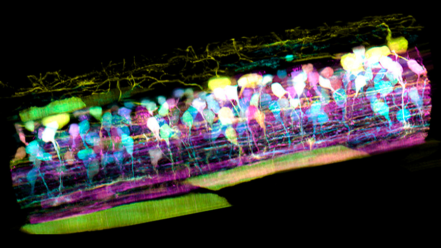 Así se mueve una célula inmune por el oído interno de un pez cebra: la imagen microscópica que llevamos 350 años buscando