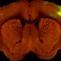 Presentan nuevo mapa de alta resolución de cómo está conectado el cerebro