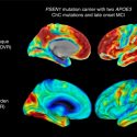 Extraña mutación salvó a una colombiana de heredar la enfermedad de Alzheimer