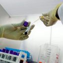 Prometedor análisis de sangre podría detectar cáncer de mama 5 años antes de sus síntomas