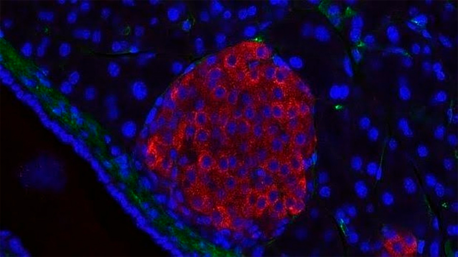 Células pancreáticas capaces de producir insulina en respuesta a la luz azul