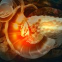 Combinación de 2 fármacos "mata de hambre" a las células malignas del cáncer de páncreas