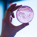 Descubren antibiótico con potencial de combatir bacterias hasta ahora resistentes a medicamentos