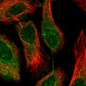 Descubren proteína que parece ser clave en la obesidad y las enfermedades metabólicas