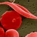 CRISPR: laboratorios afirman haber curado a primeros pacientes con enfermedades hereditarias a la sangre