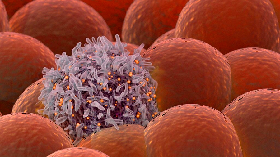 Descubren un biomarcador nuevo para las células madre del cáncer