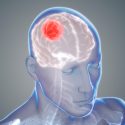 Consiguen aplicar un fármaco 1,400 veces más potente contra el cáncer cerebral que hasta ahora no podía usarse