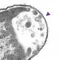 La nanotecnología puede con las superbacterias y el cáncer
