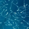 Paciente termina generando espermatozoides ajenos luego de recibir un trasplante de médula ósea