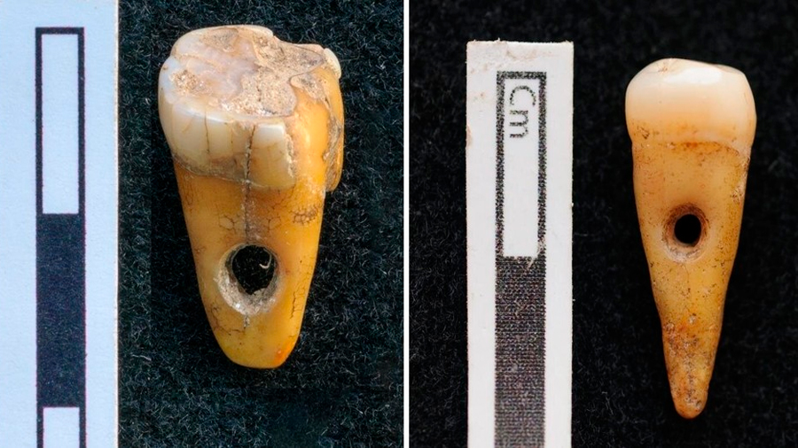 Descubren dientes humanos usados como joyería en Turquía