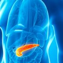 Exceso de grasa en el páncreas es una de las causas de aparición de a diabetes tipo 2