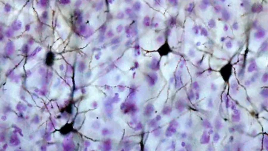 Los neurocientíficos descubren un nuevo tipo de señal en el cerebro humano