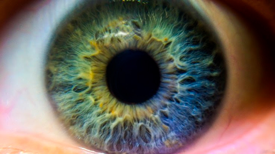 Hombre acude a emergencias por jaquecas y dolor ocular; le detectan sífilis en el sistema nervioso