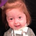 Niña de 2 años con una condición única que acelera su envejecimiento