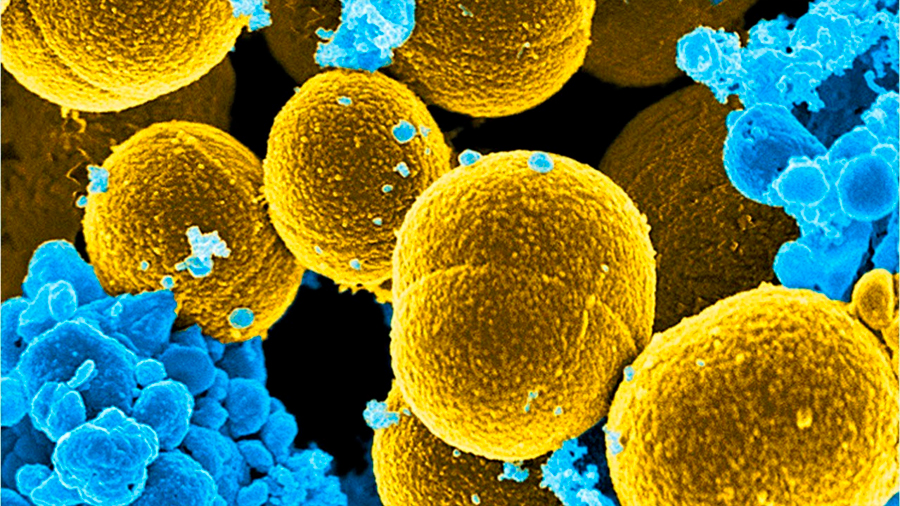 Cientificos descubren dos nuevas alternativas para combatir resistencia bacteriana