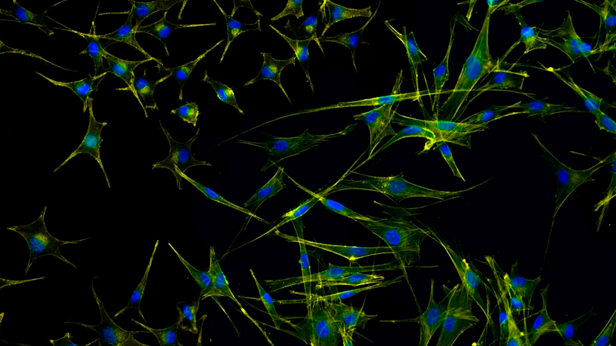 Dos prebióticos ayudan a ratones a combatir el melanoma activando la inmunidad antitumoral