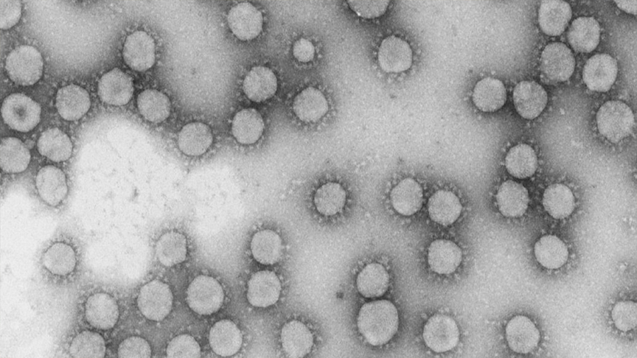 Demuestran "in vitro" que un fármaco frena un coronavirus similar al Covid-19