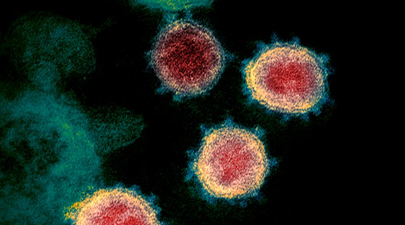Científicos rusos logran descifrar la totalidad del genoma del nuevo coronavirus