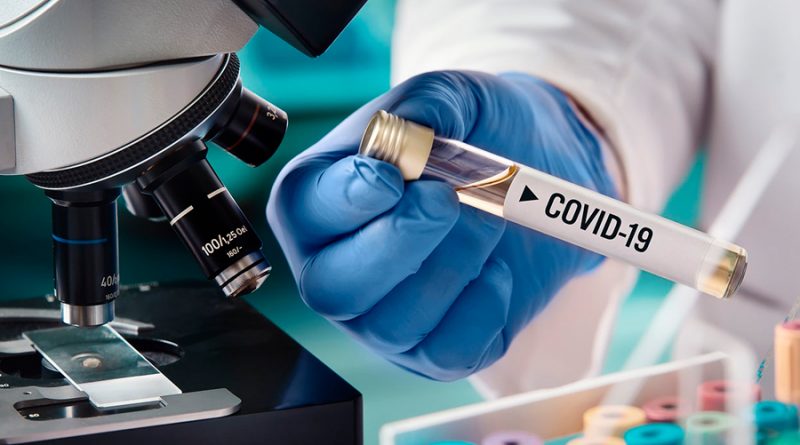 Así son las pruebas PCR que se utilizan para detectar el coronavirus
