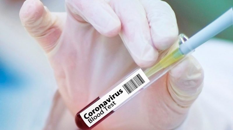 Científicos descubren el momento en el que los pacientes con coronavirus dejan de ser contagiosos