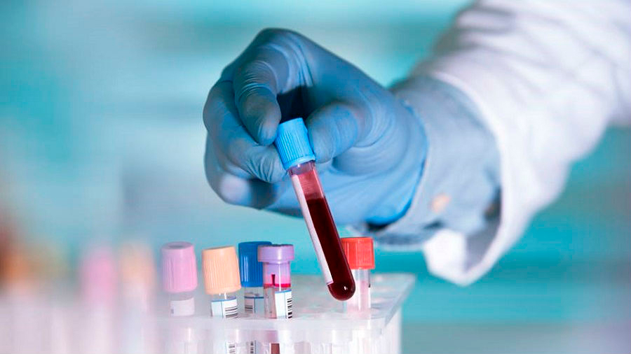 Crean prueba de sangre para detección temprana de 50 tipos de cáncer