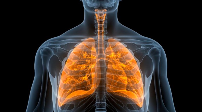 La IA predice casos de coronavirus con riesgo de daño pulmonar
