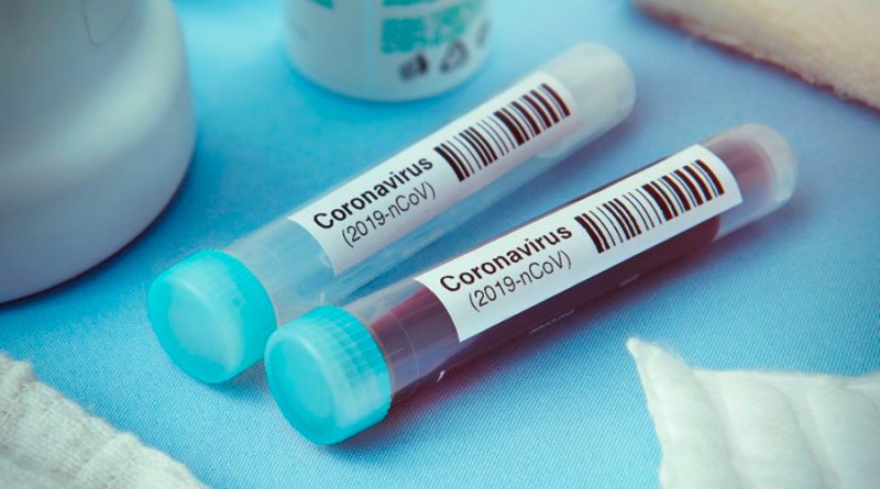 Pfizer anuncia diversos avances en los tratamientos y una posible vacuna contra el coronavirus