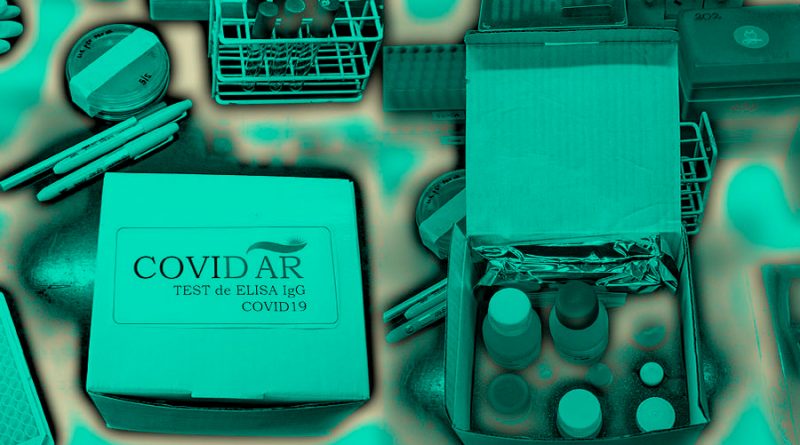 Argentinos crean el primer test EN al para detectar anticuerpos contra la COVID-19