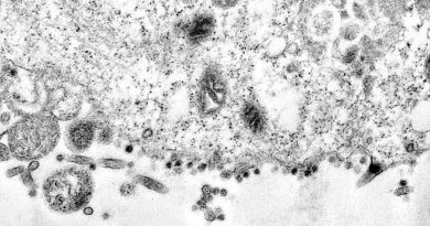 Científicos brasileños captan el momento en el que el coronavirus infecta una célula