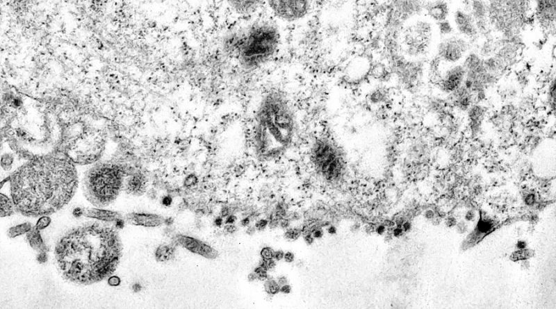 Científicos brasileños captan el momento en el que el coronavirus infecta una célula
